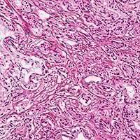 ASTERAND Tissue