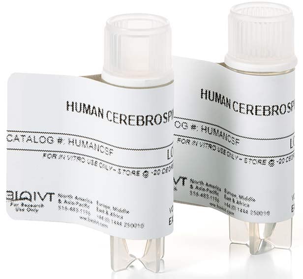 Human CSF vials